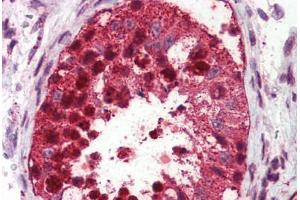 Testis, Human: Formalin-Fixed, Paraffin-Embedded (FFPE) (USP2 Antikörper  (C-Term))