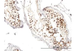 Immunostaining (ISt) image for anti-DNA Repair Protein Homolog 1 (RAD51) (AA 1-339) antibody (ABIN519604)