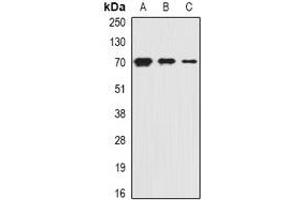 Western blot analysis of PiT2 expression in HepG2 (A), mouse kidney (B), rat liver (C) whole cell lysates. (SLC20A2 Antikörper)
