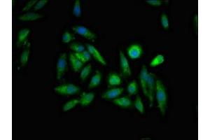 Immunofluorescent analysis of Hela cells using ABIN7156293 at dilution of 1:100 and Alexa Fluor 488-congugated AffiniPure Goat Anti-Rabbit IgG(H+L) (ITPR1 Antikörper  (AA 1707-1966))