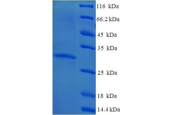 YPEL3 Protein (AA 1-119, full length) (His-SUMO Tag)