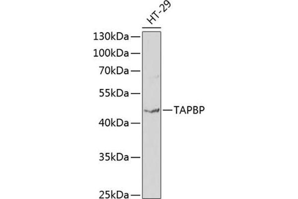 TAPBP anticorps  (AA 30-260)