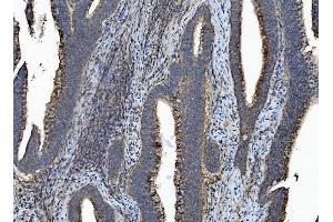 anti-Caspase 7, Apoptosis-Related Cysteine Peptidase (CASP7) (AA 24-303) antibody