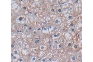 IHC-P analysis of Human Tissue, with DAB staining. (GGT1 Antikörper  (AA 122-299))
