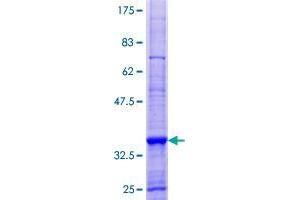 Image no. 1 for rho/rac Guanine Nucleotide Exchange Factor (GEF) 18 (ARHGEF18) (AA 1-89) protein (GST tag) (ABIN1345543) (ARHGEF18 Protein (AA 1-89) (GST tag))