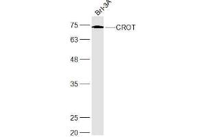Brl-3A lysates probed with CROT Polyclonal Antibody, Unconjugated  at 1:300 dilution and 4˚C overnight incubation. (CROT Antikörper  (AA 201-275))
