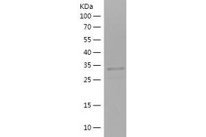 SLC27A2 Protein (AA 28-106) (His-IF2DI Tag)