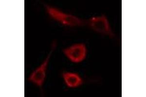 ABIN6274492 staining Hela cells by IF/ICC. (C1orf35 Antikörper  (C-Term))
