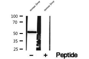 Western blot analysis of extracts of mouse liver tissue, using SUOX antibody. (SUOX Antikörper  (Internal Region))