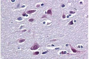 Human Brain, Cortex: Formalin-Fixed, Paraffin-Embedded (FFPE) (RBM9 Antikörper  (AA 1-100))