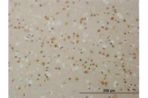 Image no. 1 for anti-Transducin (Beta)-Like 1X-Linked (TBL1X) (AA 478-578) antibody (ABIN598960) (TBL1X Antikörper  (AA 478-578))