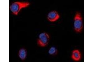 Immunofluorescent analysis of PIP5K staining in HepG2 cells. (PIKFYVE Antikörper  (N-Term))