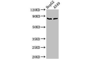 Western Blot Positive WB detected in: HepG2 whole cell lysate, A549 whole cell lysate All lanes: CFB antibody at 2. (Complement Factor B Antikörper  (AA 23-761))