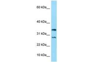 Image no. 1 for anti-NADH Dehydrogenase (Ubiquinone) 1 alpha Subcomplex, 11, 14.7kDa (NDUFA11) (AA 15-64) antibody (ABIN6748211) (NDUFA11 Antikörper  (AA 15-64))