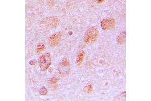 Immunohistochemical analysis of RPL17 staining in human brain formalin fixed paraffin embedded tissue section. (RPL17 Antikörper  (Center))