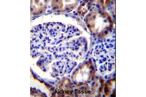RICTOR Antibody (C-term) (ABIN391385 and ABIN2841393) immunohistochemistry analysis in formalin fixed and paraffin embedded human kidney tissue followed by peroxidase conjugation of the secondary antibody and DAB staining. (RICTOR Antikörper  (C-Term))