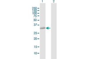 Western Blot analysis of STX12 expression in transfected 293T cell line by STX12 MaxPab polyclonal antibody. (Syntaxin 12 Antikörper  (AA 1-276))