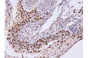 IHC analysis of PHF21A using anti-PHF21A antibody (ABIN6719353).