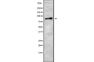 Western blot analysis of ADAM8 using HepG2 whole cell lysates (ADAM8 Antikörper  (Internal Region))