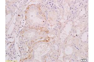 Immunohistochemistry (IHC) image for anti-Tumor Necrosis Factor Receptor Superfamily, Member 13C (TNFRSF13C) (AA 121-184) antibody (ABIN740760)