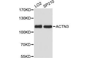 Western blot analysis of extracts of various cell lines, using ACTN3 antibody (ABIN6290056) at 1:3000 dilution. (ACTN3 Antikörper)