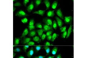 Immunofluorescence analysis of HeLa cells using RAN Polyclonal Antibody (RAN Antikörper)