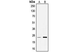 Western blot analysis of TCEAL6 expression in A549 (A), Jurkat (B) whole cell lysates. (TCEAL6 Antikörper  (Center))