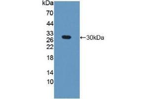 Western blot analysis of recombinant Mouse GAMT. (GAMT Antikörper  (AA 2-236))