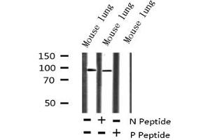 Western Blotting (WB) image for anti-Tumor Protein P73 (TP73) (pTyr99) antibody (ABIN6256817)