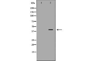 Western blot analysis of Hela whole cell lysates, using RFC4 Antibody. (RFC4 Antikörper)