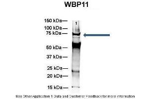 Amount and Sample Type :  500 ug mouse brain homogenate  Amount of IP Antibody :  6 ug  Primary Antibody :  WB Primary Antibody Dilution :  1:500  Secondary Antibody :  Goat anti-rabbit Alexa-Fluor 594  Secondary Antibody Dilution :  1:5000  Gene Name :  WB Submitted by :  Dr. (WBP11 Antikörper  (N-Term))