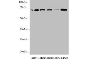 Western blot All lanes: ZBTB48 antibody at 0. (ZBTB48 Antikörper  (AA 1-280))