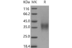 Western Blotting (WB) image for Low Affinity Immunoglobulin gamma Fc Region Receptor IV (FCGR4) (Active) protein (Biotin,His-Avi Tag) (ABIN7320420)