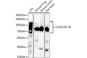 Western blot analysis of extracts of various cell lines, using CD36/SR-B3 antibody (ABIN6132248, ABIN6138173, ABIN6138174 and ABIN6221473) at 1:810 dilution. (CD36 Antikörper  (AA 30-270))