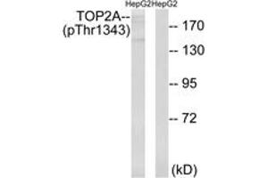 Western blot analysis of extracts from HepG2 cells treated with Ca2+ 40nM 30', using TOP2A (Phospho-Thr1343) Antibody. (Topoisomerase II alpha Antikörper  (pThr1343))