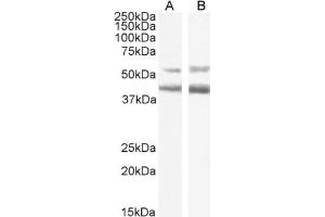 Western Blot using anti-CCR4 antibody KW-0761 (Mogamulizumab). (Rekombinanter CCR4 (Mogamulizumab Biosimilar) Antikörper)