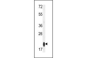 Western blot analysis of RT25 Antibody (C-term) (ABIN653808 and ABIN2843083) in MCF-7 cell line lysates (35 μg/lane). (MRPS25 Antikörper  (C-Term))