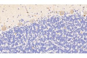 Immunohistochemistry (IHC) image for anti-Hemoglobin antibody (ABIN7437245)