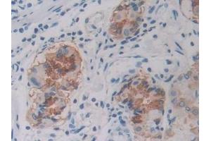 Immunohistochemistry (IHC) image for anti-ATP-Binding Cassette, Sub-Family A (ABC1), Member 1 (ABCA1) (AA 1385-1663) antibody (ABIN7433309)
