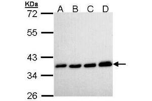 Western Blotting (WB) image for anti-Pyrophosphatase (Inorganic) 1 (PPA1) antibody (ABIN2856784)