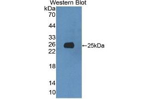 XRN1 Antikörper  (AA 1567-1723)