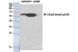Western Blot (WB) analysis of specific cells using Acetyl-NFkappaB-p65 (K310) Polyclonal Antibody. (NF-kB p65 Antikörper  (acLys310))