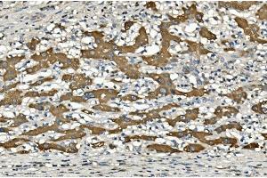 IHC analysis of Cytochrome p450 2C19/CYP2C19 using anti-Cytochrome p450 2C19/CYP2C19 antibody (ABIN7603007).