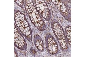 Immunohistochemical staining of human rectum with CHMP4B polyclonal antibody  shows strong granular cytoplasmic positivity in glandular cells. (CHMP4B Antikörper)