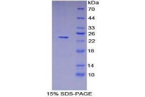SDS-PAGE (SDS) image for HLA Class II DR alpha (HLA-DRA) (AA 25-216) protein (His tag) (ABIN1878849)