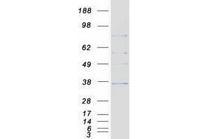 Validation with Western Blot (ZDHHC4 Protein (Transcript Variant 3) (Myc-DYKDDDDK Tag))