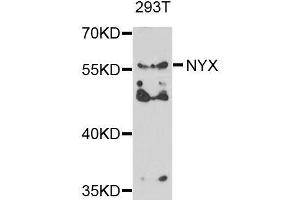 Western blot analysis of extracts of 293T cells, using NYX antibody. (Nyctalopin Antikörper  (AA 282-481))