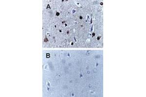 Formalin-fixed, paraffin-embedded human brain sections stained for Active/Cleaved CASP9 expression using CASP9 polyclonal antibody  at 1 : 2000. (Caspase 9 Antikörper)