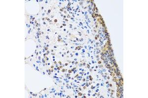 Immunohistochemistry of paraffin-embedded rat lung using MTA3 antibody (ABIN2737194) at dilution of 1:100 (40x lens). (MTA3 Antikörper)