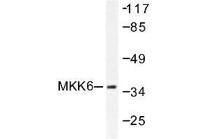 Image no. 1 for anti-Mitogen-Activated Protein Kinase Kinase 6 (MAP2K6) antibody (ABIN265521) (MAP2K6 Antikörper)